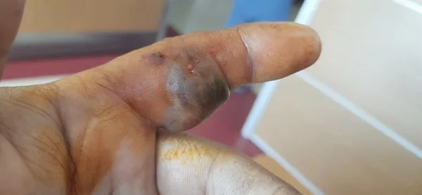 bursada-kendisini-isiran-yilanla-birlikte-hastaneye-kostu-olumle-yasam-arasinda-mucadele-1653562001806.jpg Bursa'da kendisini ısıran yılanla birlikte hastaneye koştu🐍 Ölümle yaşam arasında mücadele - 5