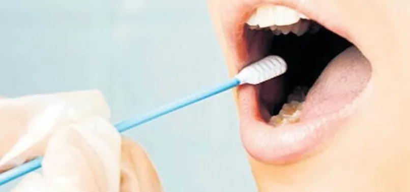 Tükürük testiyle 193 hastalık belirlenecek