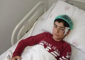 Aksaray’da koyun otlatan küçük çocuk pitbull saldırısına uğradı! "Kardeşlerim olmasaydı beni daha kötü yapacaktı"