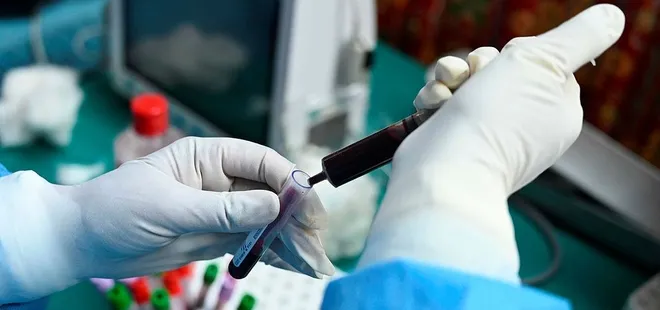 Dikkat öldürücü! Nezleye benziyor sakın hafife almayın