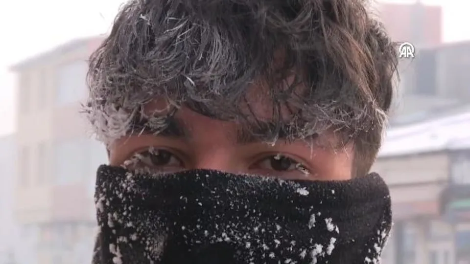 Kaşları ve kirpikleri dondu! Görüntüler Türkiye’den