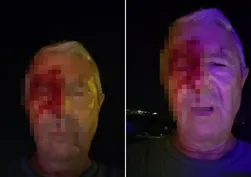 Kocaeli'de görev başındaki muhabir dehşeti yaşadı! Haber yaparken saldırıya uğradı!