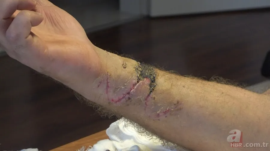 Pitbull saldırısında ölümden döndü! Canını kurtarmak için köpeği camdan attı! O anlar kamerada 7