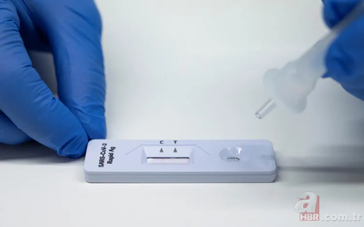 Uzmanlar 'Teşhis için çok önemli' deyip uyardı: Yüzde 60'ı pozitif! Elon Musk’ın sözleriyle yeniden gündeme geldi 15