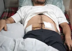 Küçük çocuğa yardım etmek isteyen genç 6 yerinden bıçaklandı | Ahmet ve Atlas'ın ardından şimdi de Oğuzhan