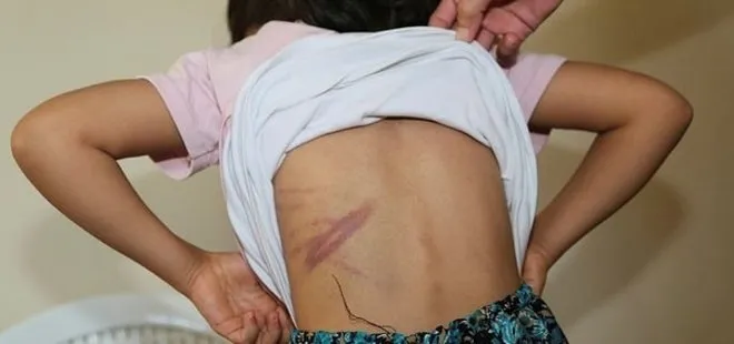Şanlıurfa’da cani baba dehşeti: Eşi ile 4 çocuğunu kemer ve sopayla dövdü
