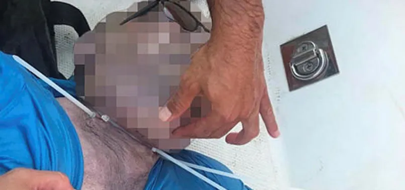 VAHÅET! PLASTİK KELEÃPE TAKILI HALDE BULUNDU