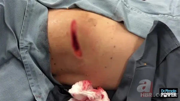 30 yıl boyunca baş ağrısıyla yaşadı! Nedeni şoke etti... 132