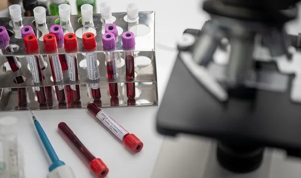 AstraZenaca ve BioNTech/Pfizer güçlerini birleştirdi | COVID-19'a karşı 'karışık doz aşılama' hamlesi! İşte şaşırtıcı sonuçlar - 5