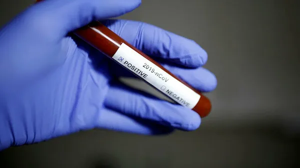son-dakika-neden-koronavirus-asisi-olmaliyiz-iste-sizlere-en-iyi-10-neden-1609089009706.jpg Son dakika: Neden koronavirüs aşısı olmalıyız? İşte sizlere en iyi 10 neden! - 10