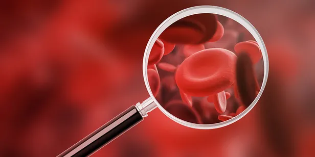 cabuk-yorulma-nefes-darligi-enerji-kaybi-gibi-belirtiler-varsa-hemen-kontrol-ettirin-tedavisi-sart-ilk-olarak-1702899660747.jpg Çabuk yorulma, nefes darlığı, enerji kaybı gibi belirtiler varsa hemen kontrol ettirin! Tedavisi şart ilk olarak kansızlık yapıyor! - 1