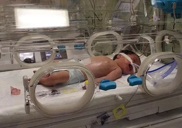 Sezaryenle ilgili yeni eylem planı yolda