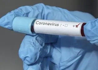 Corona virüsten hayatını kaybeden ünlüler!