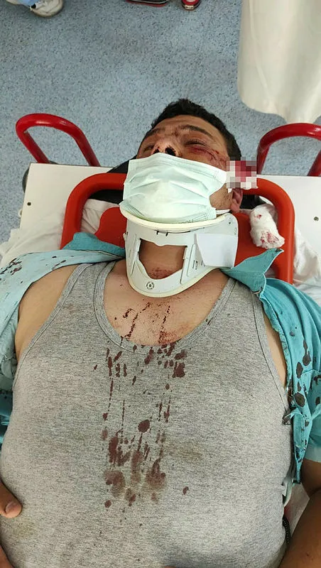1624477979672.jpg İletişim Başkanı Fahrettin Altun'dan İYİ Partili Lütfü Türkkan'ın çalışanları tarafından darp edilen gazeteci Mustafa Uslu'ya geçmiş olsun telefonu - 2