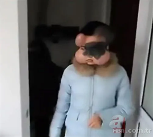 Dünyanın en tuhaf hastalıkları 14