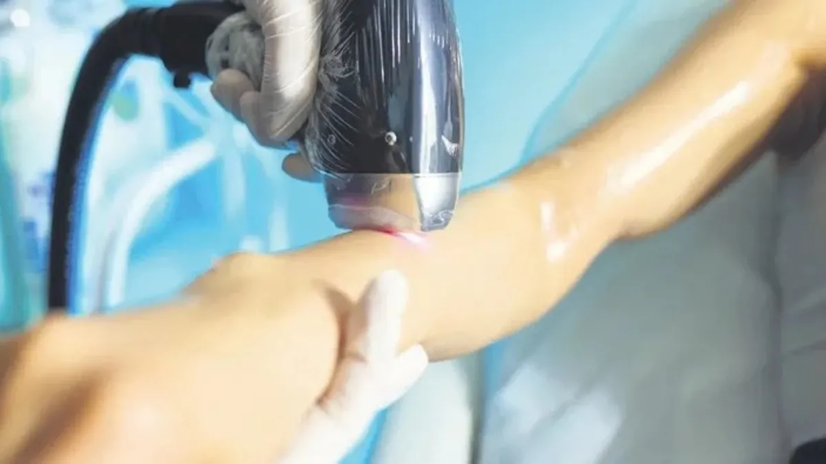 Lazer epilasyon dehşeti! Genç kız kabusu yaşadı