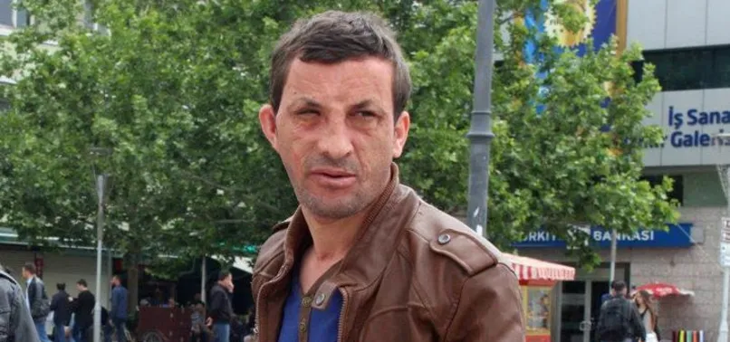 Yüz nakilli Uğur Acar'a 'cinayet' davası