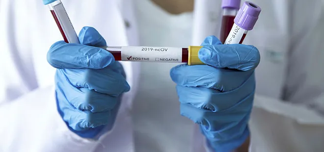 Koronavirüs İsrail’e de sıçradı! İlk vaka görüldü