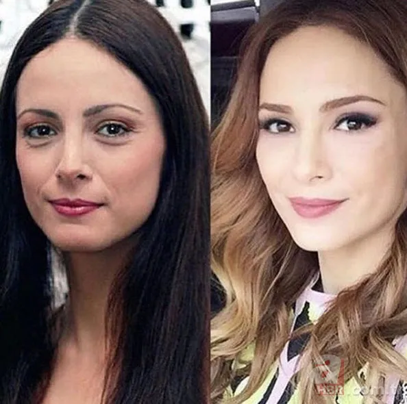 Işın Karaca da estetik kervanına katıldı! Son halini paylaştı 20