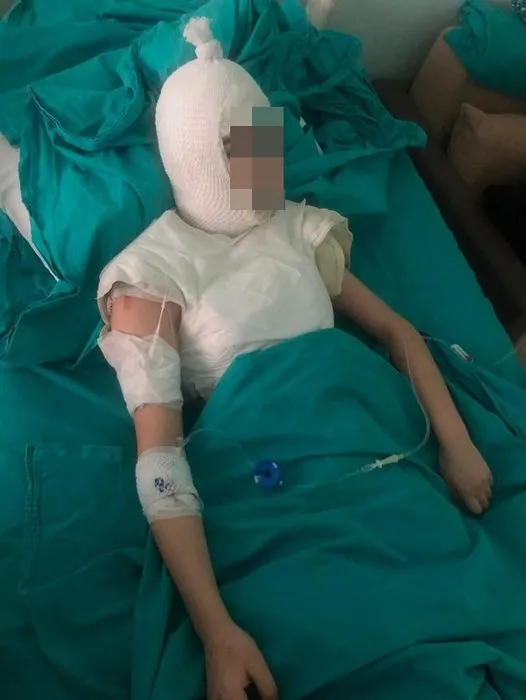 Kızının üstüne kaynar su döken üvey anne 4.5 yıl hapis istemi! Öz anne isyan etti! - 4