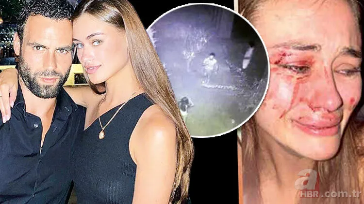 Ukraynalı manken Daria Kyryliuk saldırısında çifte şüphe! Polisler erkek arkadaşını teşhis etti 6