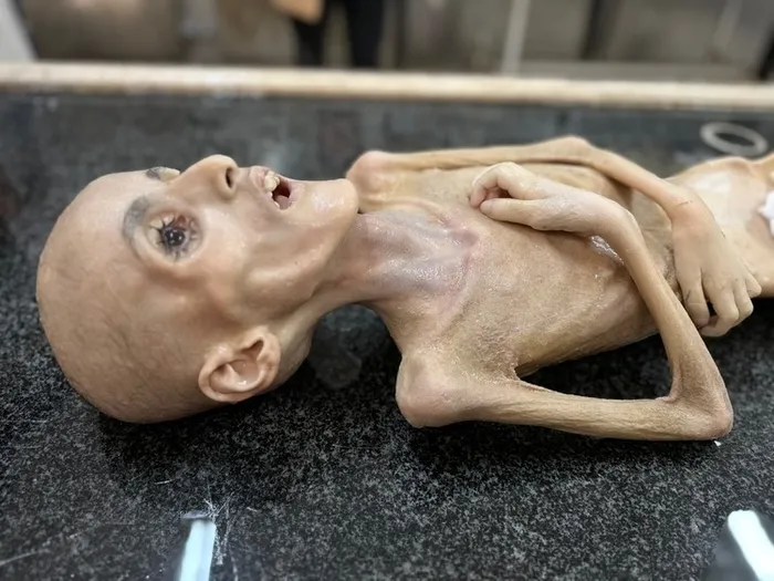 insanlik-tarihinin-en-aci-soykirimi-2-yilinda-israil-gazzede-on-binlerce-masumu-katletti-1759818584815.jpeg Gazze'de yetersiz beslenme nedeniyle hayatını kaybeden Yezen el-Kefarne. (A Haber arşiv)