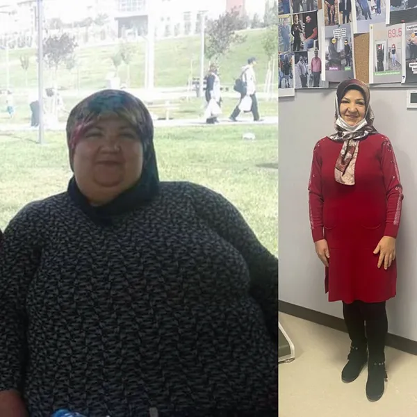 2 yılda 95 kilo verdi: Çorabımı bile giyemiyordum