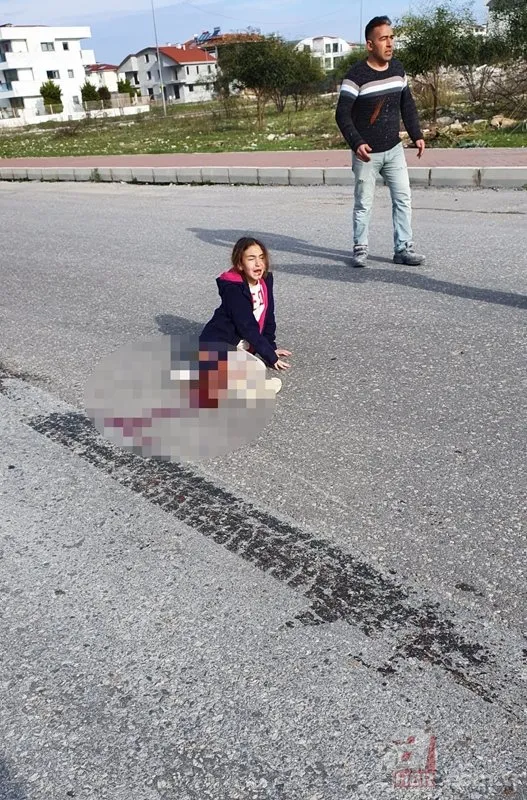 Antalya’da köpekten kaçarken kamyon çarpmıştı! Bacağı kesilen minik Mahra’dan ilk görüntü| Mahra’nın sağlık durumu nasıl?