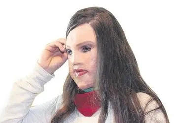 Yüz nakli tarihe karışabilir