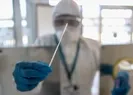 Para karşılığı negatif test!