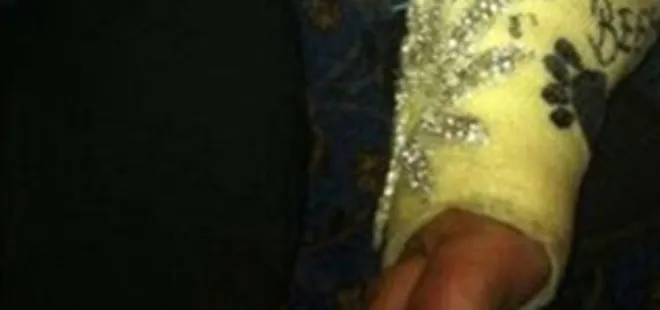 Süreyya Yalçın alçısını süslü taşlarla kaplattı