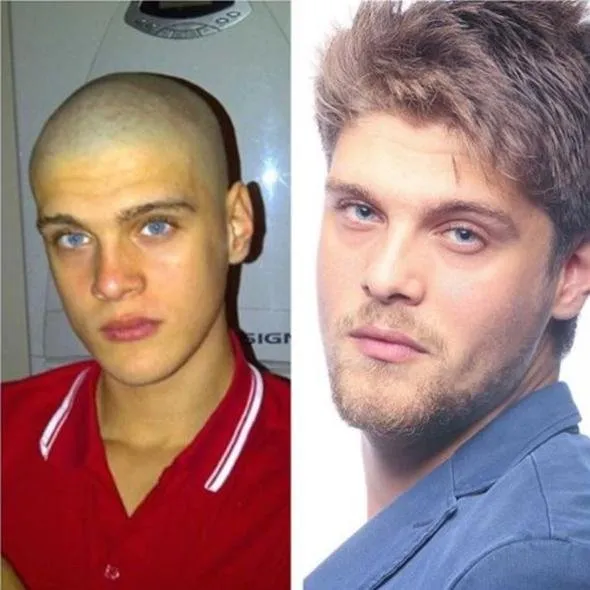 Hatice Nin Eski Halini Gorenler Sasirip Kaliyor