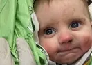 Mucize bebek annesine kavuştu!