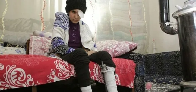 YPG’nin döşediği mayınlar hayatlarını kararttı! 15 yaşındaki Dua Zeki’nin gözü görmüyor, bacakları sakat