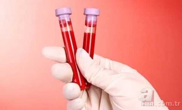 Oruçluyken kan vermek ve kan almak orucu bozar mı? Kan vermek orucu bozar mı? İşte cevabı... 8