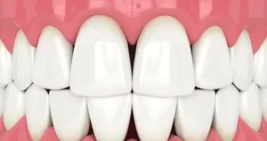 Diş aralarındaki ’siyah üçgen’lerin sebebi!