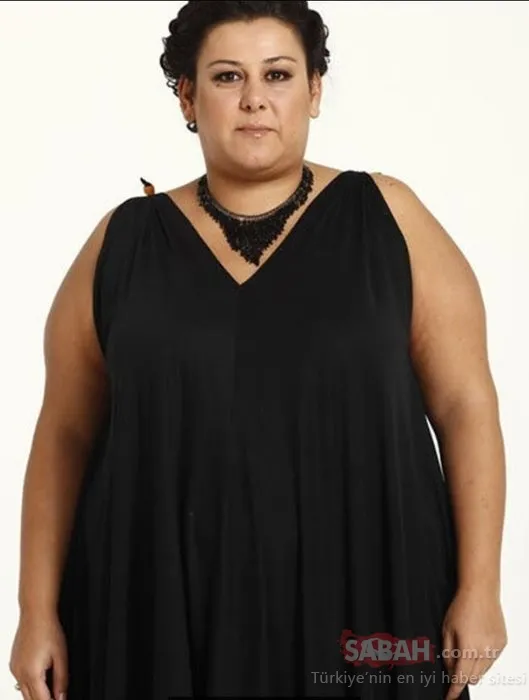 Adanalı dizisinin güzel oyuncusu Tuğçe Özbudak yeni haliyle olay oldu! Estetik yaptırmaktan öyle bir hale geldi ki... 24