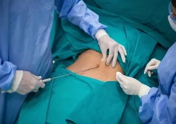 Estetik sevdası kabusu oldu! Kliniğe giden genç kadın ölümden döndü