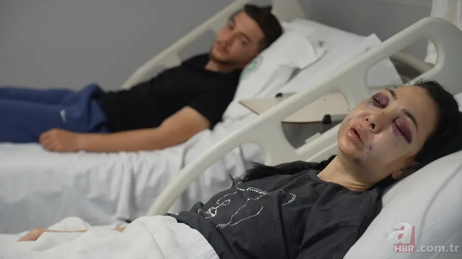 Anne ve oğlunu öldüresiye dövüp 'merdivenden düştü' dediler: Meğer ilk vukuatları değilmiş 1