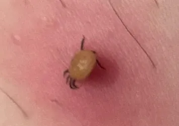 Kene bir can daha aldı! Gümüşhane’den acı haber
