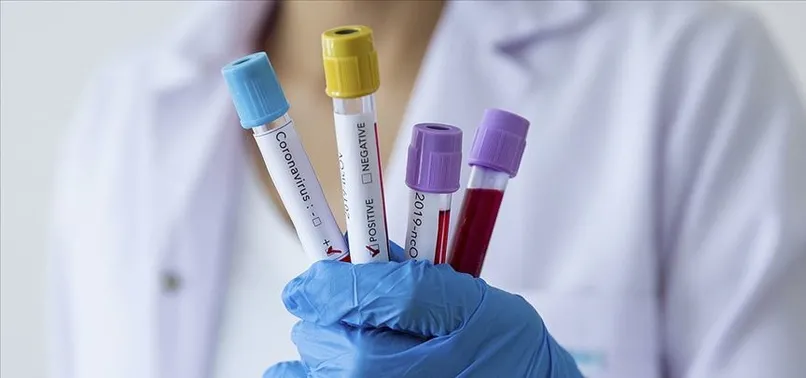 Son dakika: Sağlık Bakanlığı koronavirüs vaka sayılarını açıkladı