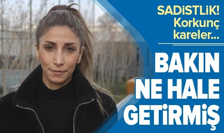 Ankara'de veteriner hekim Yağmur Denli’ye sevgili şiddeti: Sadistlik boyutunda!