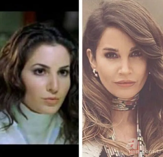 Kuzey Yıldızı İlk Aşk’ın Yıldız’ı Aslıhan Güner’in estetiksiz hali sosyal medyayı salladı! 19