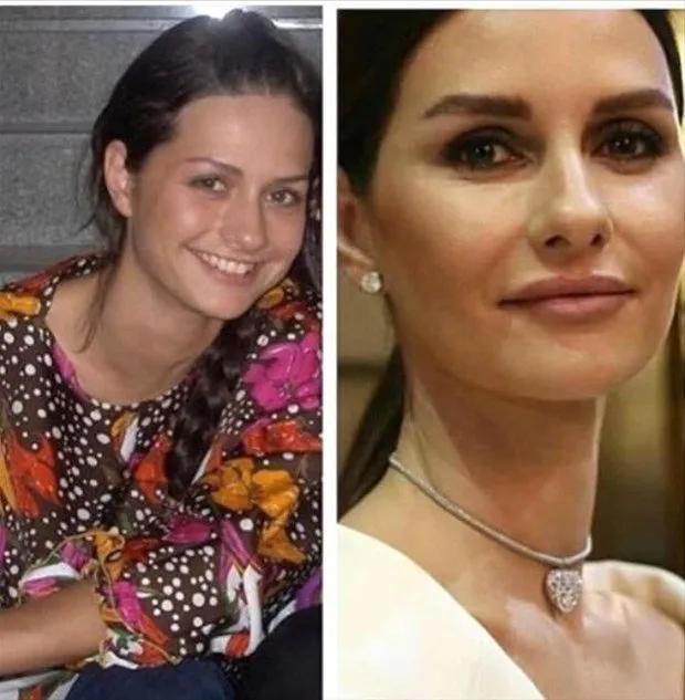 ariza nin halide si ayca aysin turan in estetiksiz hali soke etti iste ayca aysin turan in inanilmaz degisimi