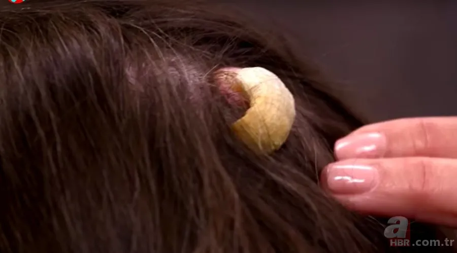 Bilim insanları şaşkın! Kafasında boynuz çıktı... 5