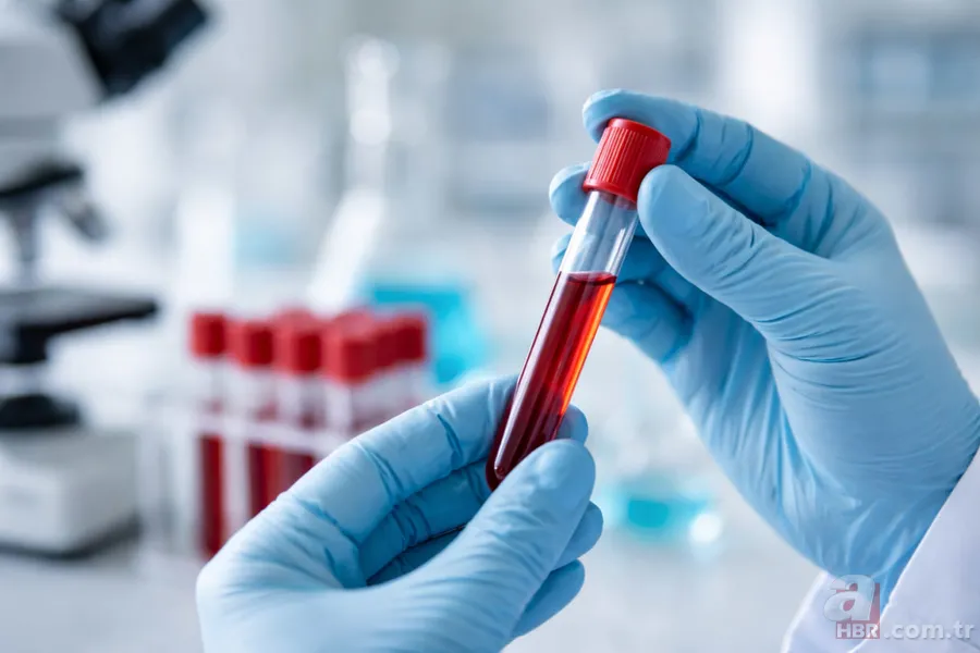 Yeni araştırma: O kan grubunda diyabet riski yüksek 3