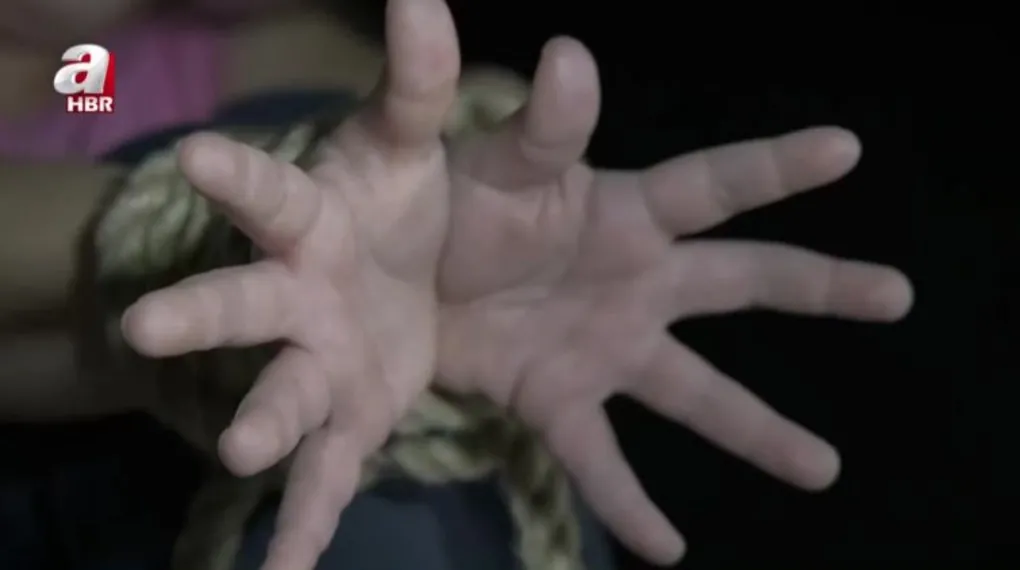 ANALİZ| Batı medeniyetinin çöküşü: Epstein skandalı!