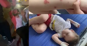 1,5 yaşındaki bebeğe işkence!
