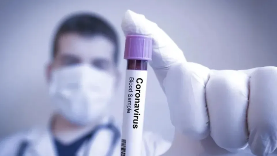 Corona virüs (koronavirüs) testi hangi hastanelerde ücretsiz? Sağlık Bakanlığı liste yayınladı