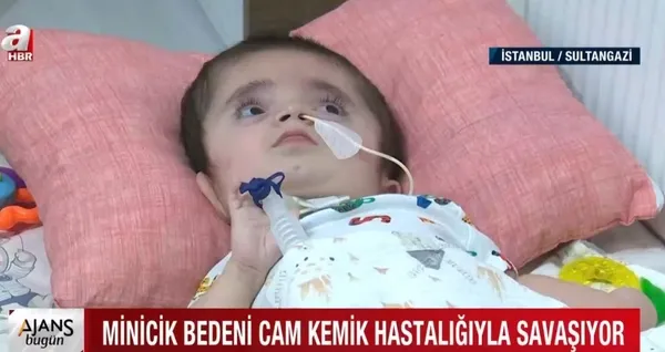 anne-karninda-cam-kemik-hastaligina-yakalanan-omer-alinin-yasam-mucadelesi-1626862439878.jpg Anne karnında 'cam kemik' hastalığına yakalanan Ömer Ali'nin yaşam mücadelesi - 2